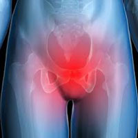 pelvic-girdle-pain